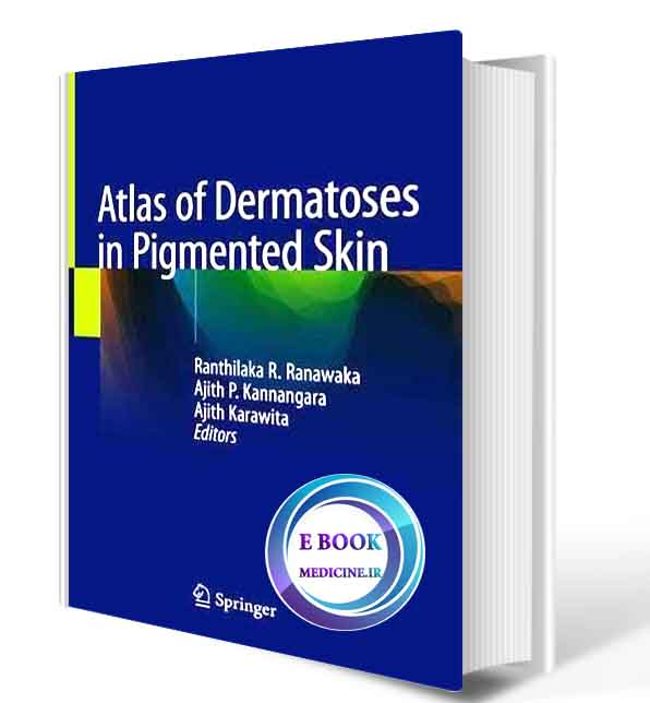 دانلود کتاب Atlas of Dermatoses in Pigmented Skin 2020 (Original Pdf ) 